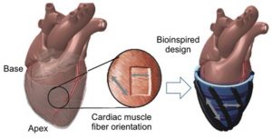 fiber orientation